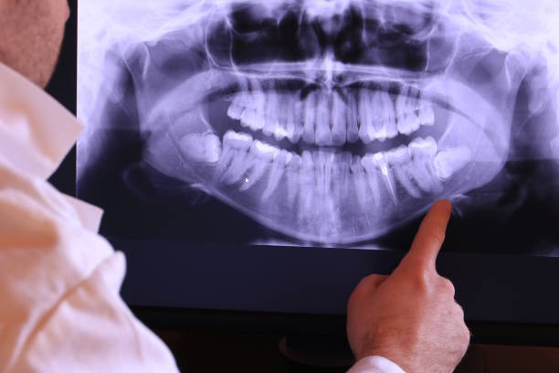 Best Emergency Root Canal Treatment in St Ignace, MI