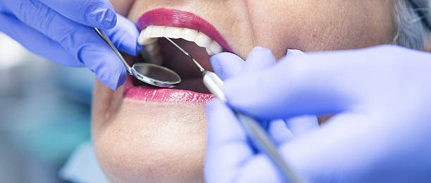 Best Emergency Tooth Extraction in St Ignace, MI
