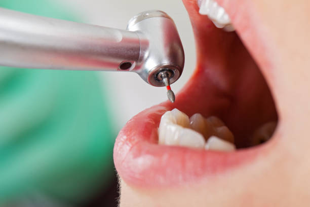 Best Cosmetic Emergency Dentistry in St Ignace, MI